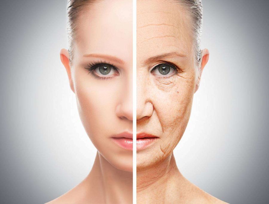 botox vs acide hyaluronique