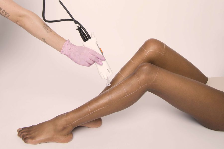 qui a le droit de pratiquer l'épil laser