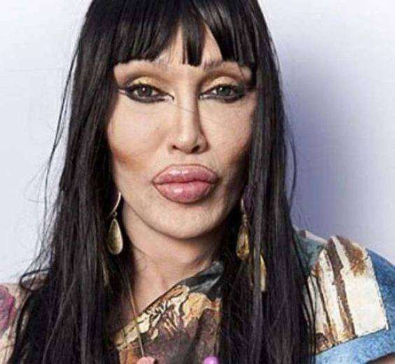 chirurgie esthetique