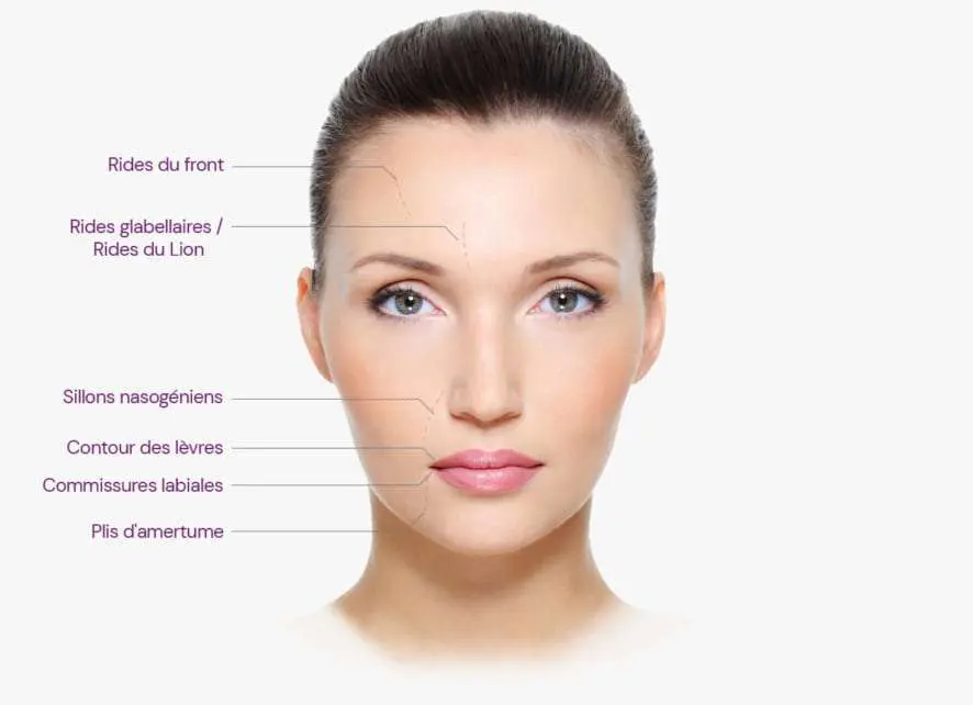 Les rides du visage
