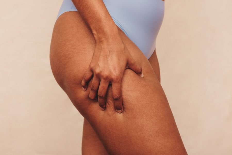 comment affiner ses cuisses